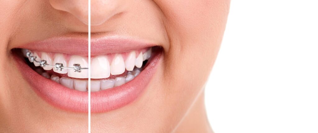 Tips For A Smooth Orthodontic Experience