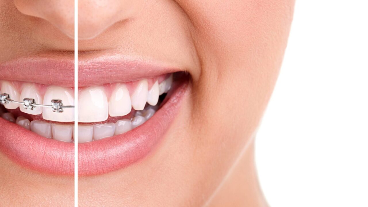 Tips For A Smooth Orthodontic Experience